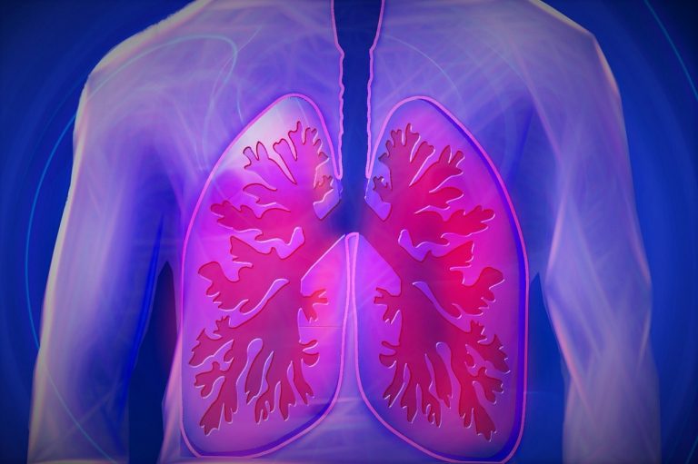 Maladie respiratoire exacerbée par l’aspirine