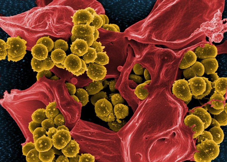 Une flore intestinale saine grâce aux probiotiques ?