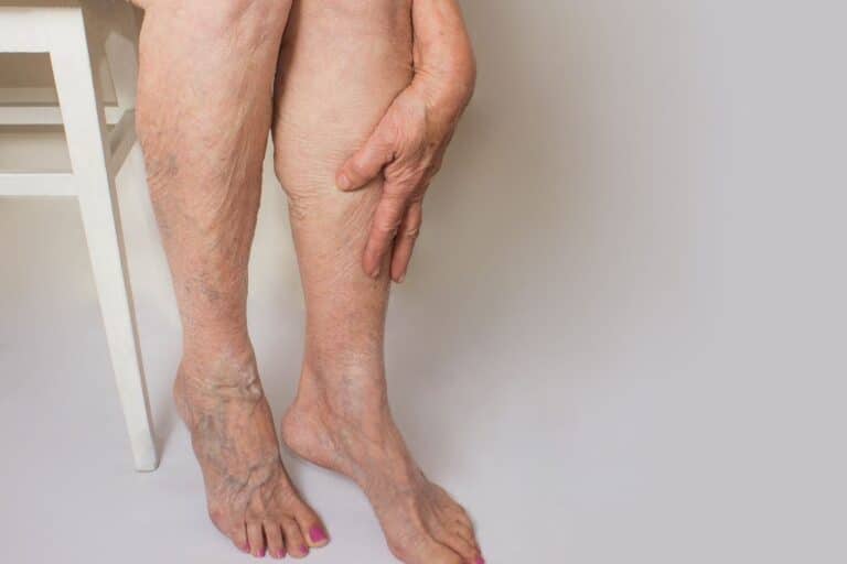 Comment soulager les jambes lourdes des seniors ? 