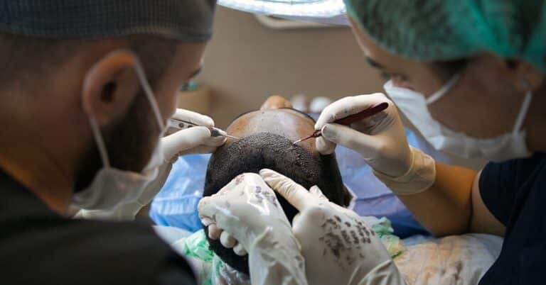 Implants de cheveux : Comment trouver le meilleur pour une opération ?